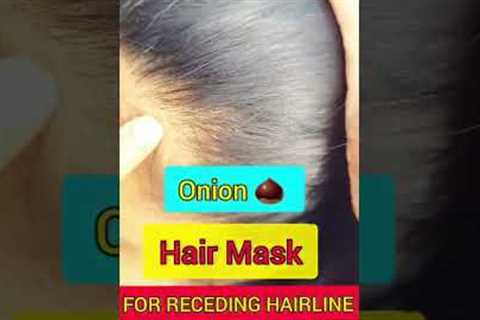 Receding hairline regrowth treatment at home|Onion oil for hair growth