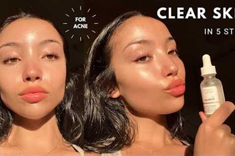 my updated skincare routine | unsponsored skincare for acne