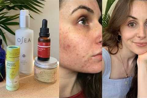 My Skin Care Routine & How I Cleared my Acne Without Fancy Products | minimalist & low waste