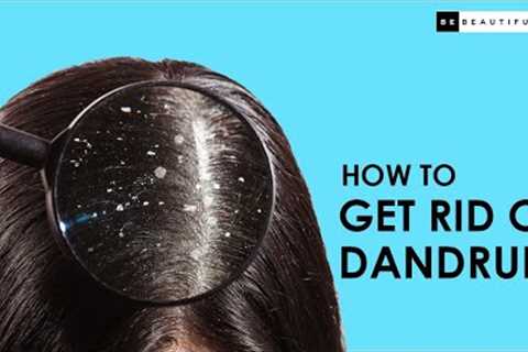 How To Get Rid of Dandruff Permanently | Easy At-Home Hair Care Routine | Be Beautiful