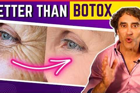 ERASE CROWS FEET IN DAYS WITHOUT BOTOX !!