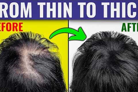 The Ultimate Guide to Thicker Hair – Dr. Berg''s Expert Advice