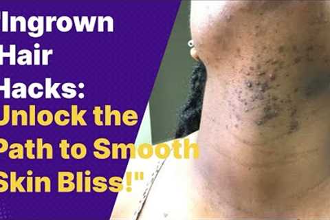 Ingrown Hair Treatment: Ultimate Guide to Smooth Skin