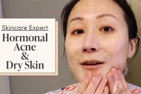 A Dermatologist’s Nighttime Skincare Routine for Hormonal Acne & Dry Skin | Skincare Expert